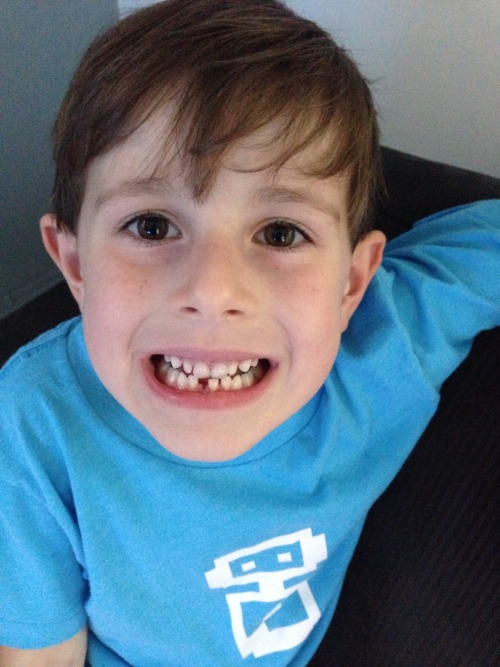 Decker lost his first tooth on Friday 8/1!